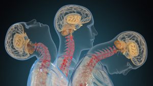 Visual representation of the human brain and spine showing multiple head and neck positions, emphasizing their structural alignment.
